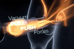 Revolutionair speeltje gespot...