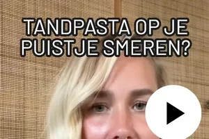 Geen tandpasta op je puistje || Je huid raakt niet gewend aan je crème || Niet elke alcohol droogt uit